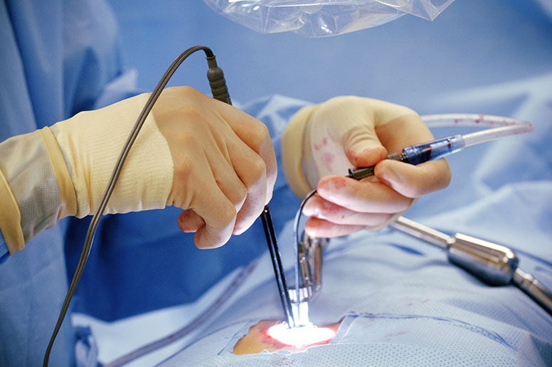 Less Invasive Cardiac Surgery